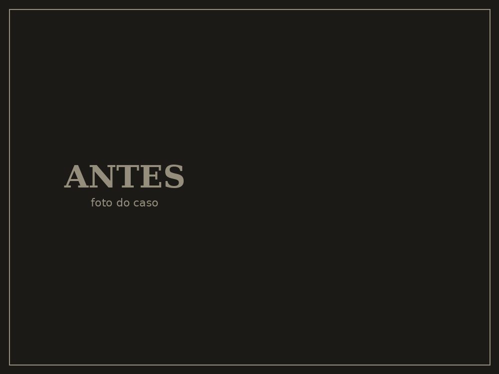Antes — Implante dentário