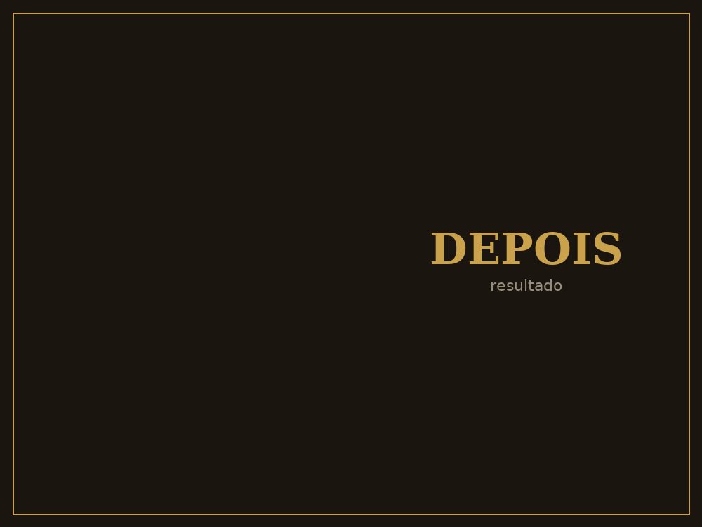 Depois — Implante dentário